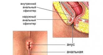 गुदा में दरार का इलाज कैसे और किसके साथ करें: गोलियाँ, मलहम, लोक उपचार पुरुषों में गुदा में दरार का इलाज