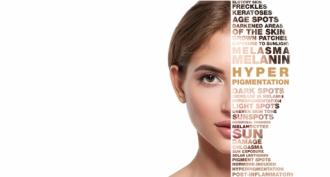 त्वचा की फोटोएजिंग (एक्टिनिक डर्मेटोसिस या हेलियोडर्मेटाइटिस) - पराबैंगनी किरणों के प्रभाव में त्वचा की तेजी से उम्र बढ़ने लगती है